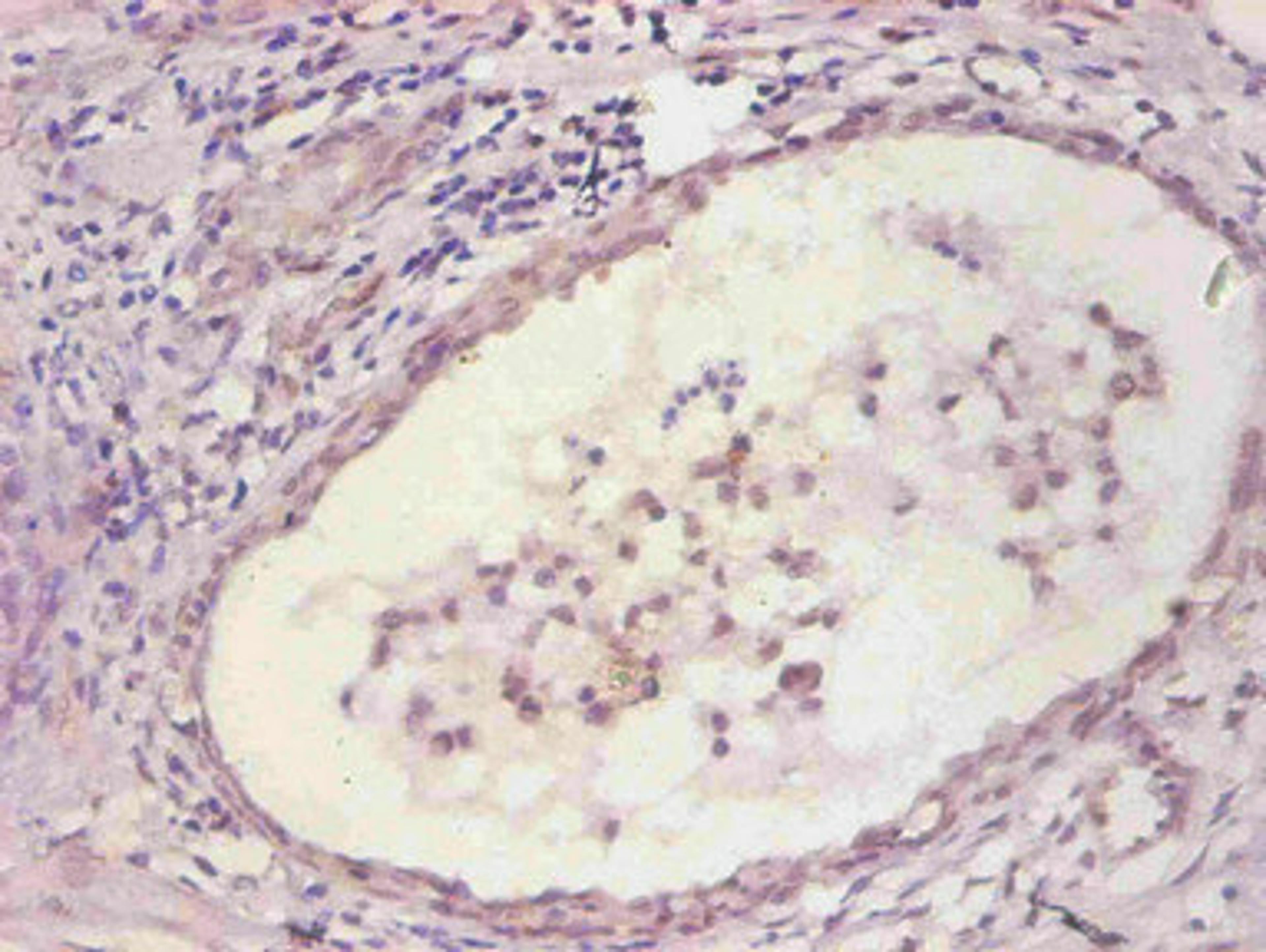 Immunohistochemical of paraffin-embedded human prostate tissue using CSB-MA067571A0m at dilution of 1:200