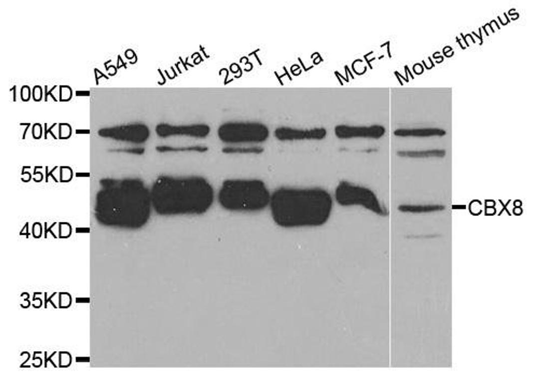 Western blot analysis of extracts of various cell lines using CBX8 antibody