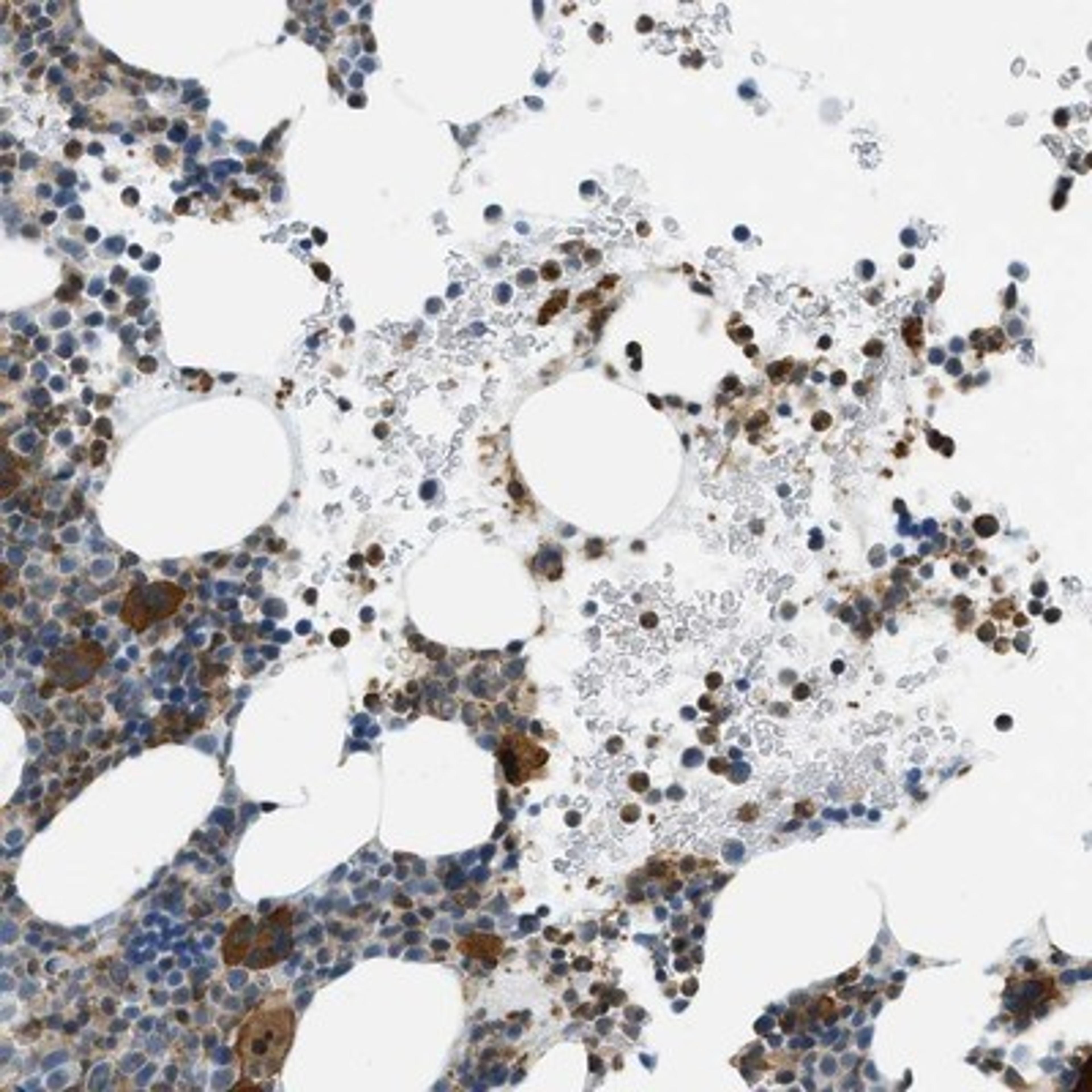 Immunohistochemistry-Paraffin: STRC Antibody [NBP1-84261] - Immunohistochemical staining of human bone marrow shows strong cytoplasmic positivity in Megakaryocytes.