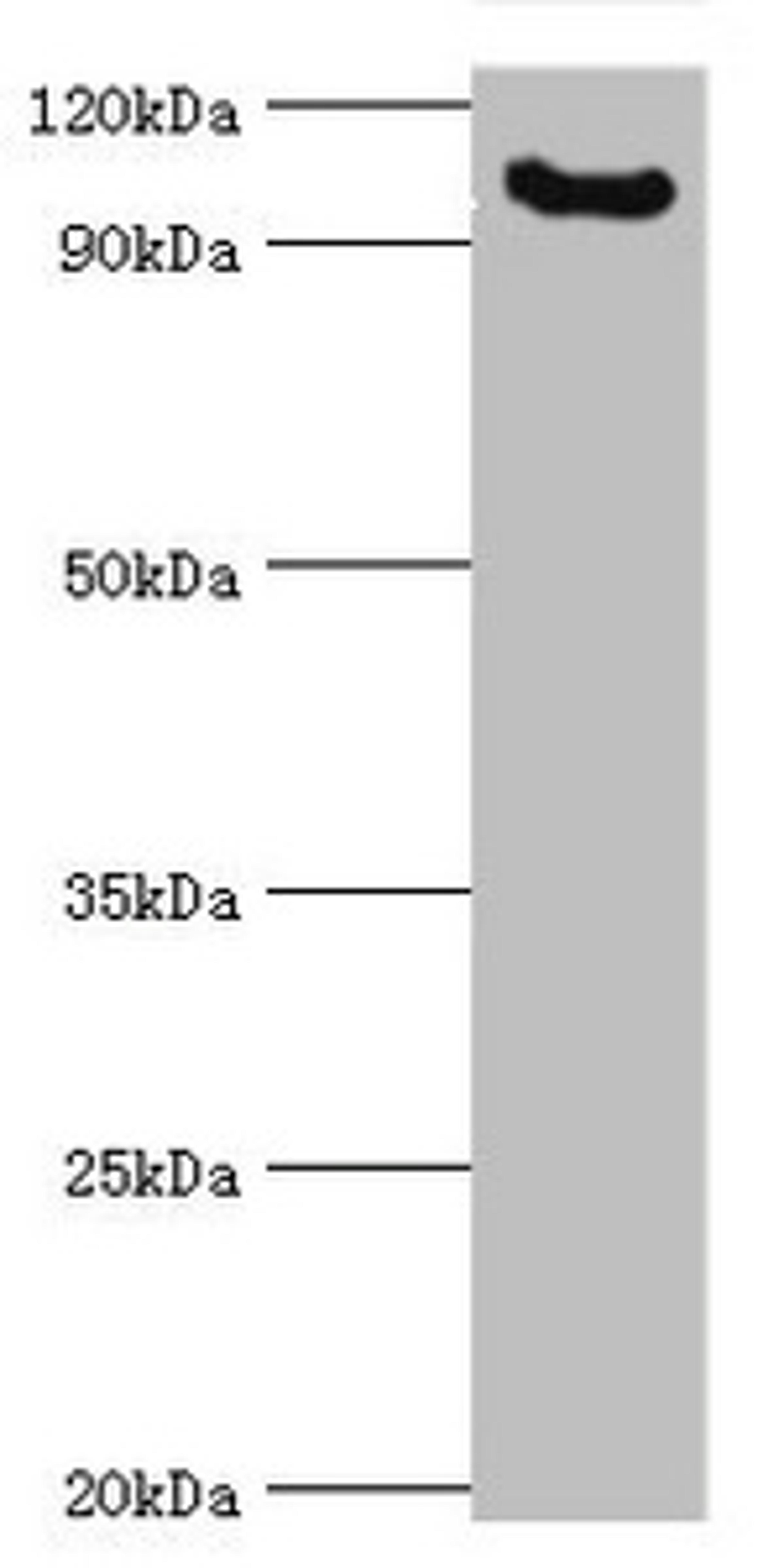 Western blot. All lanes: Microcephalin antibody at 3ug/ml + Mouse liver tissue. Secondary. Goat polyclonal to rabbit IgG at 1/10000 dilution. Predicted band size: 93, 63, 68 kDa. Observed band size: 93 kDa.