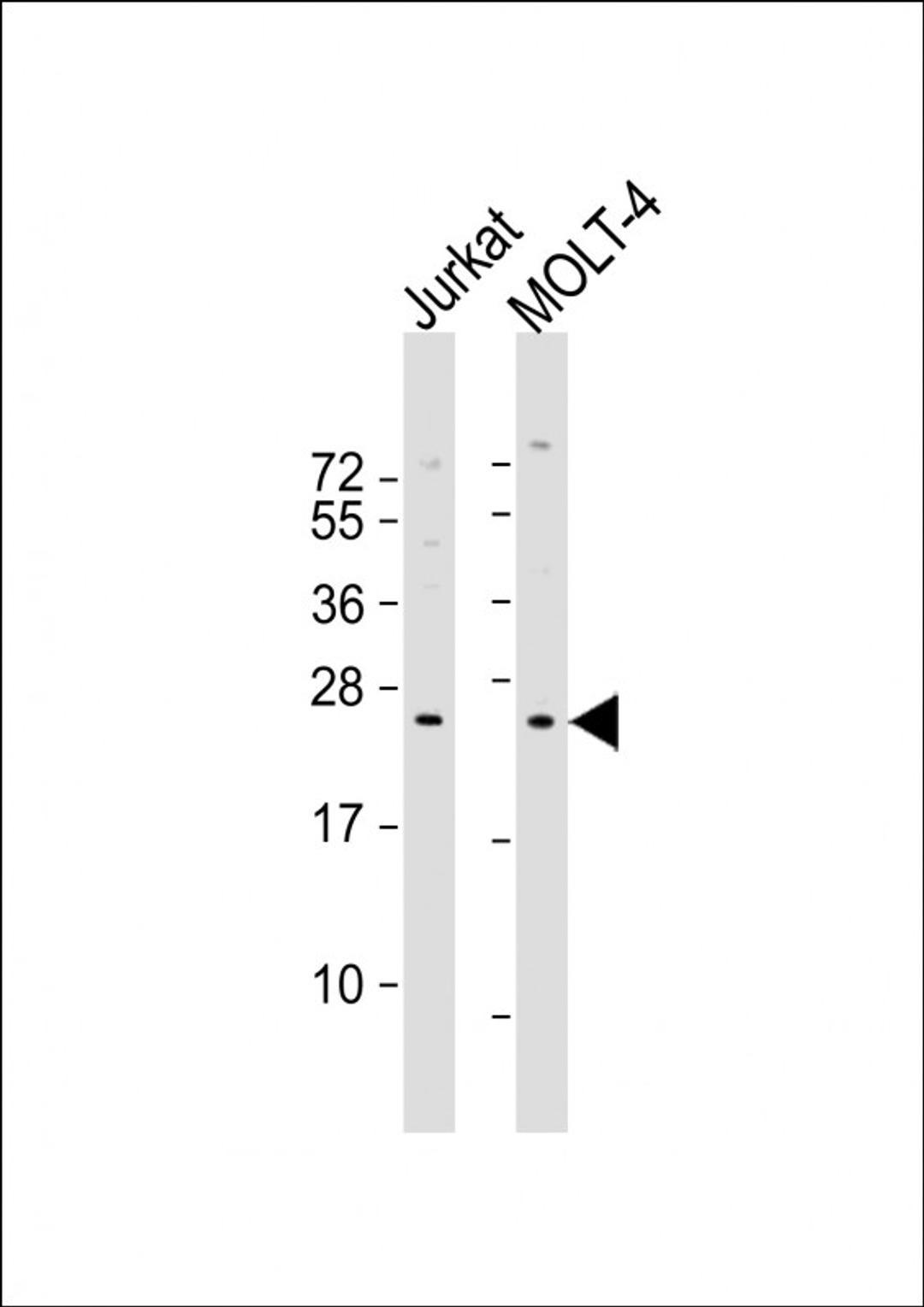 Western Blot at 1:1000 dilution Lane 1: Jurkat whole cell lysate Lane 2: MOLT-4 whole cell lysate Lysates/proteins at 20 ug per lane.