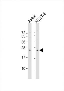 Western Blot at 1:1000 dilution Lane 1: Jurkat whole cell lysate Lane 2: MOLT-4 whole cell lysate Lysates/proteins at 20 ug per lane.