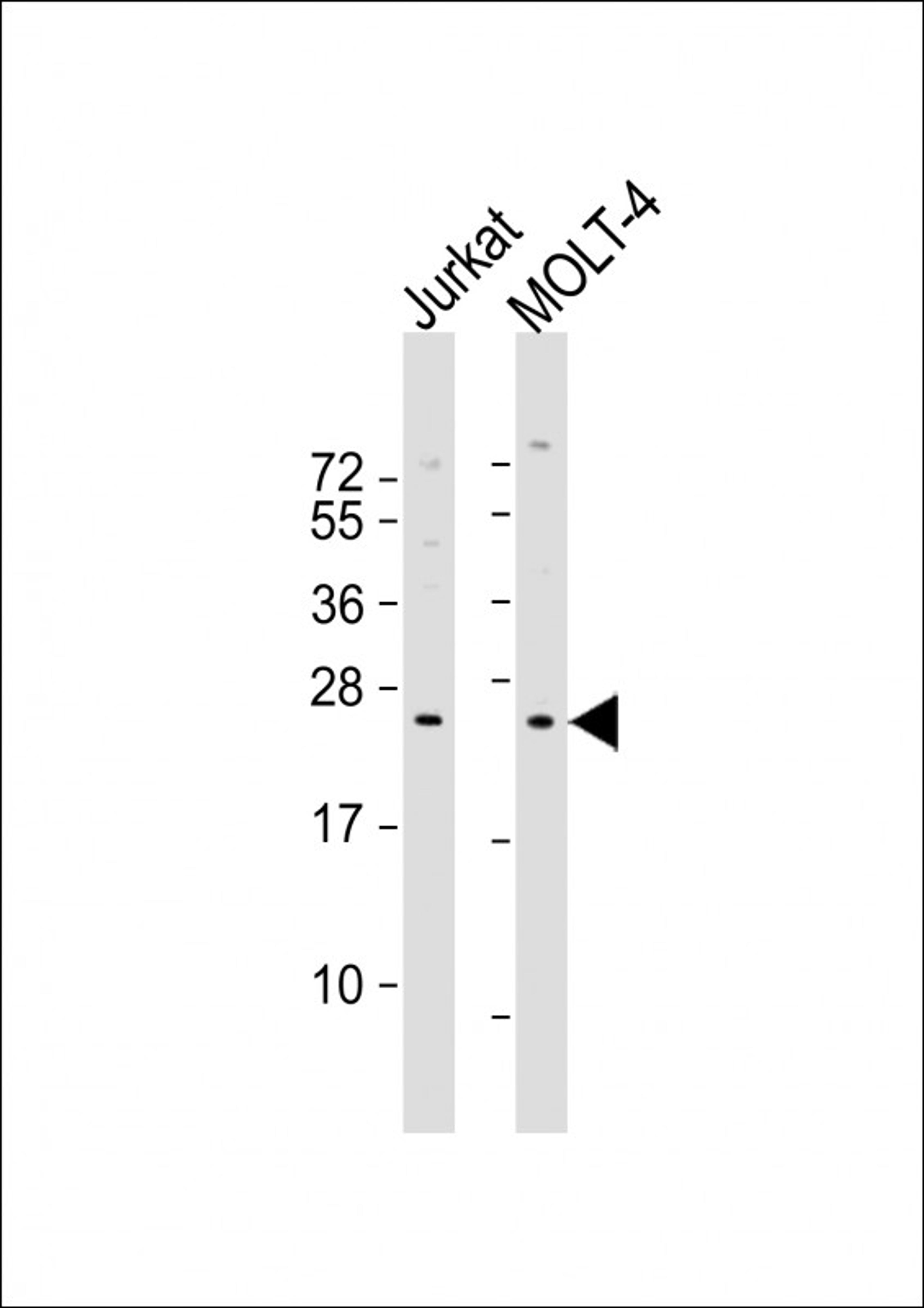 Western Blot at 1:1000 dilution Lane 1: Jurkat whole cell lysate Lane 2: MOLT-4 whole cell lysate Lysates/proteins at 20 ug per lane.