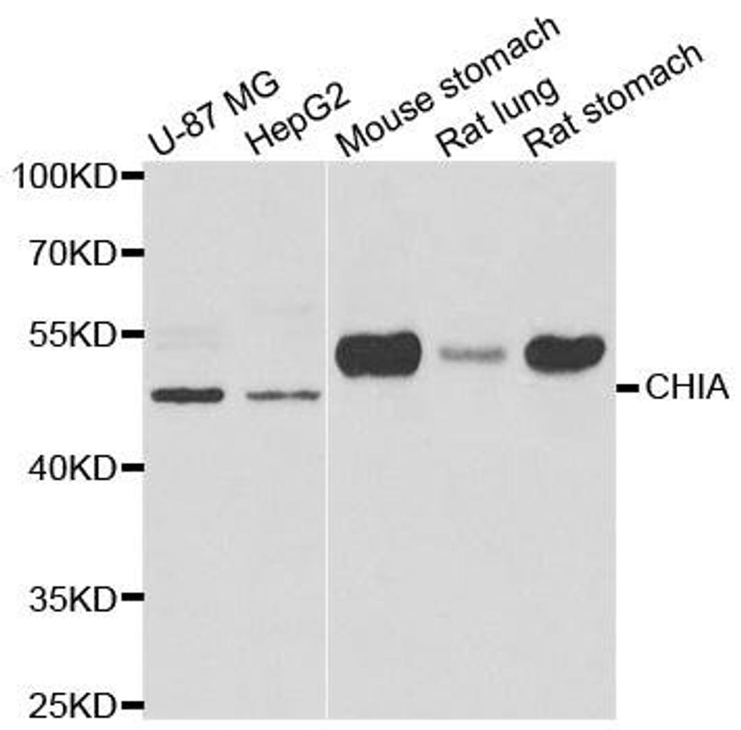 Western blot analysis of extracts of various cell lines using CHIA antibody