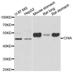 Western blot analysis of extracts of various cell lines using CHIA antibody