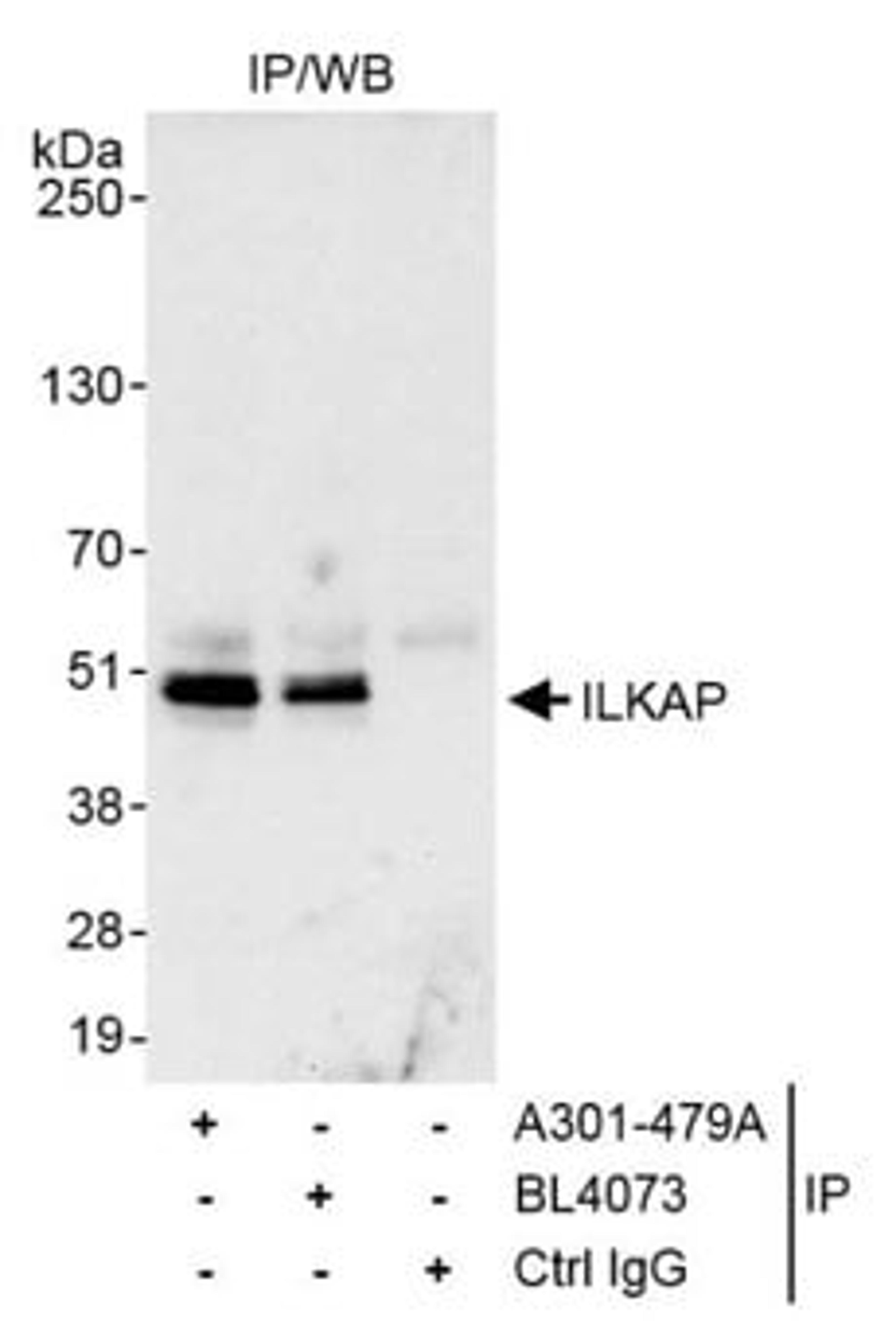 Detection of human ILKAP by western blot of immunoprecipitates.