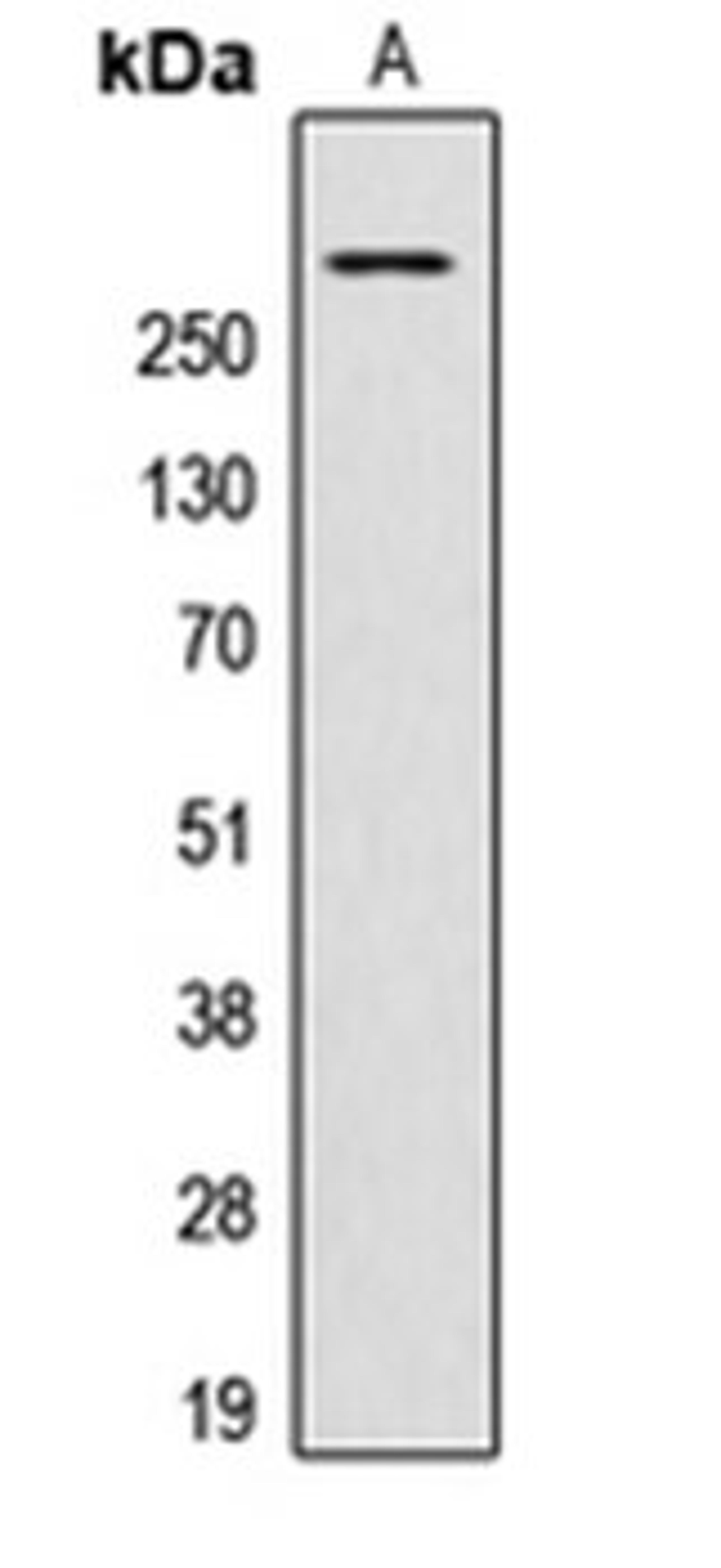 Western blot analysis of HeLa (Lane 1) whole cell lysates using AKAP13 antibody