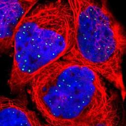 Immunocytochemistry/Immunofluorescence: CLIC3 Antibody [NBP1-89465] - Staining of human cell line A-431 shows positivity in nuclei.