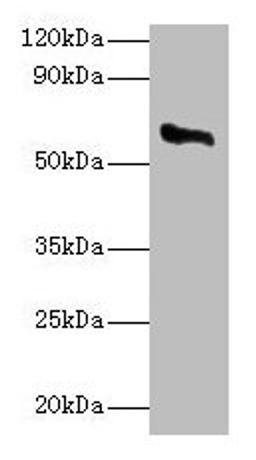 Western blot. All lanes: CYP11A1 antibody at 2µg/ml + Rat adrenal gland tissue. Secondary. Goat polyclonal to rabbit IgG at 1/10000 dilution. Predicted band size: 61, 43 kDa. Observed band size: 61 kDa