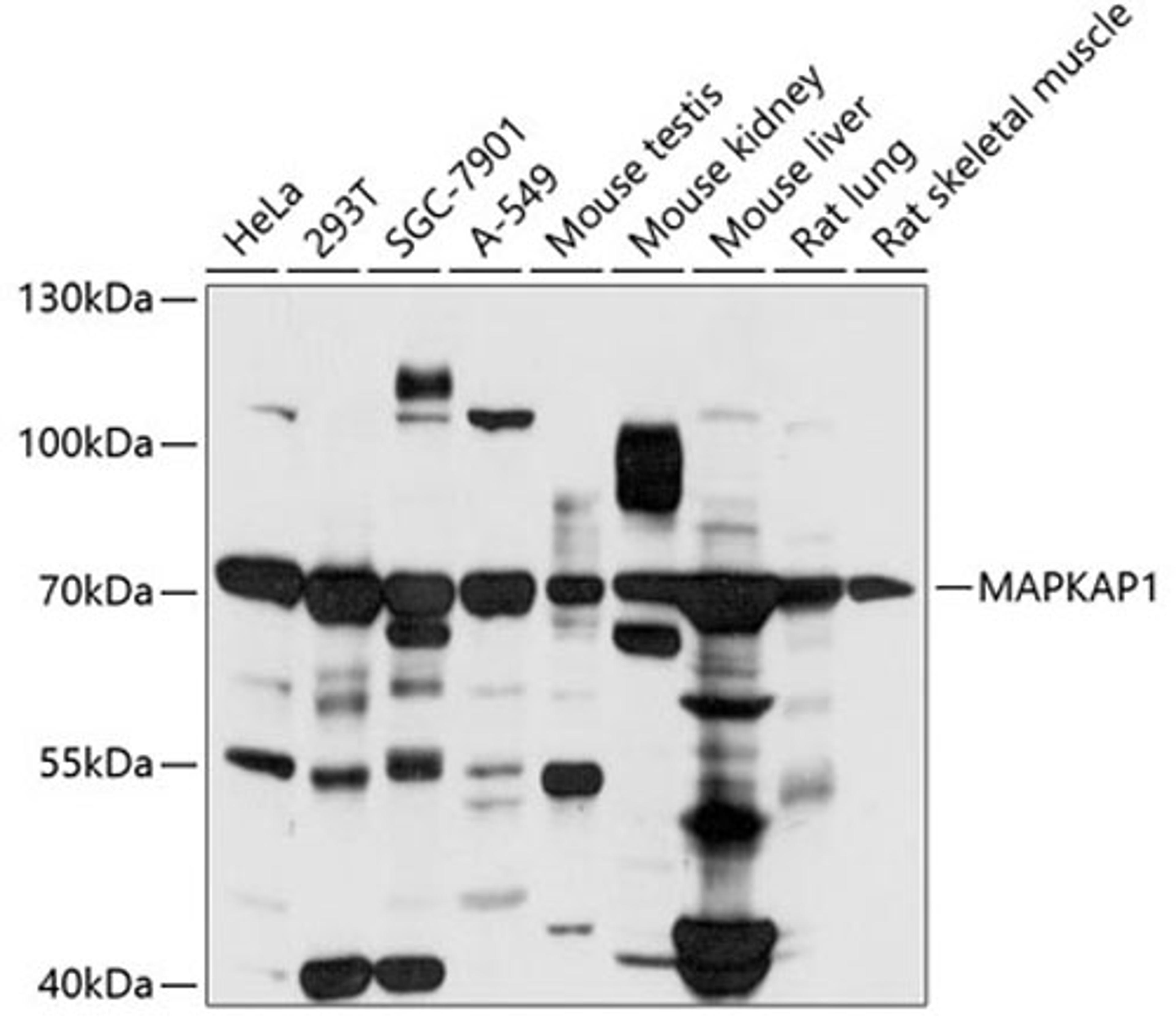 Western blot - MAPKAP1 antibody (A6648)