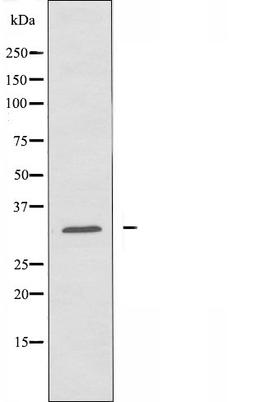 Western blot analysis of HUVEC cells and COLO cells using ABHD11 antibody