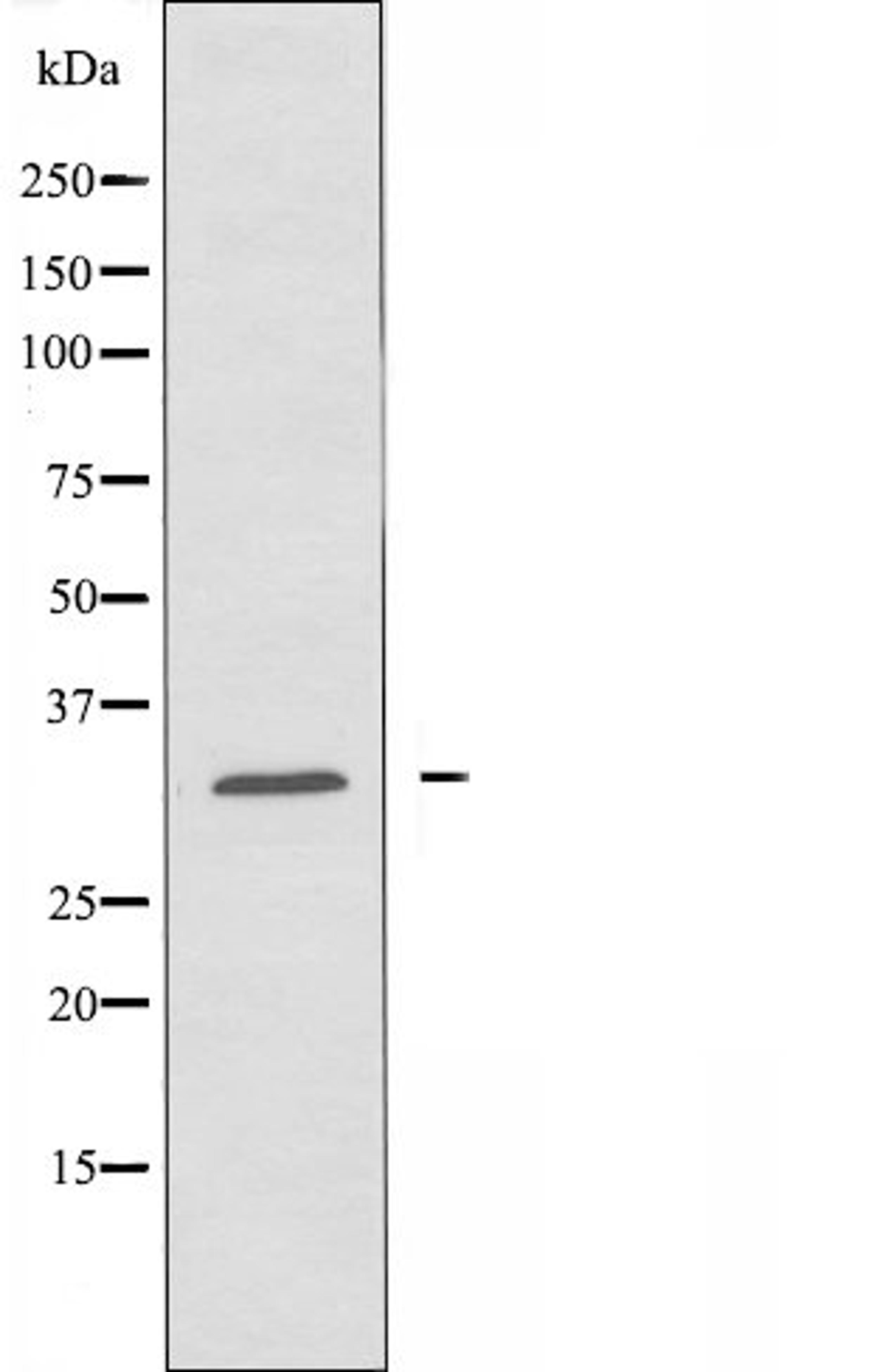 Western blot analysis of Jurkat cells and HUVEC cells using OR10J6 antibody