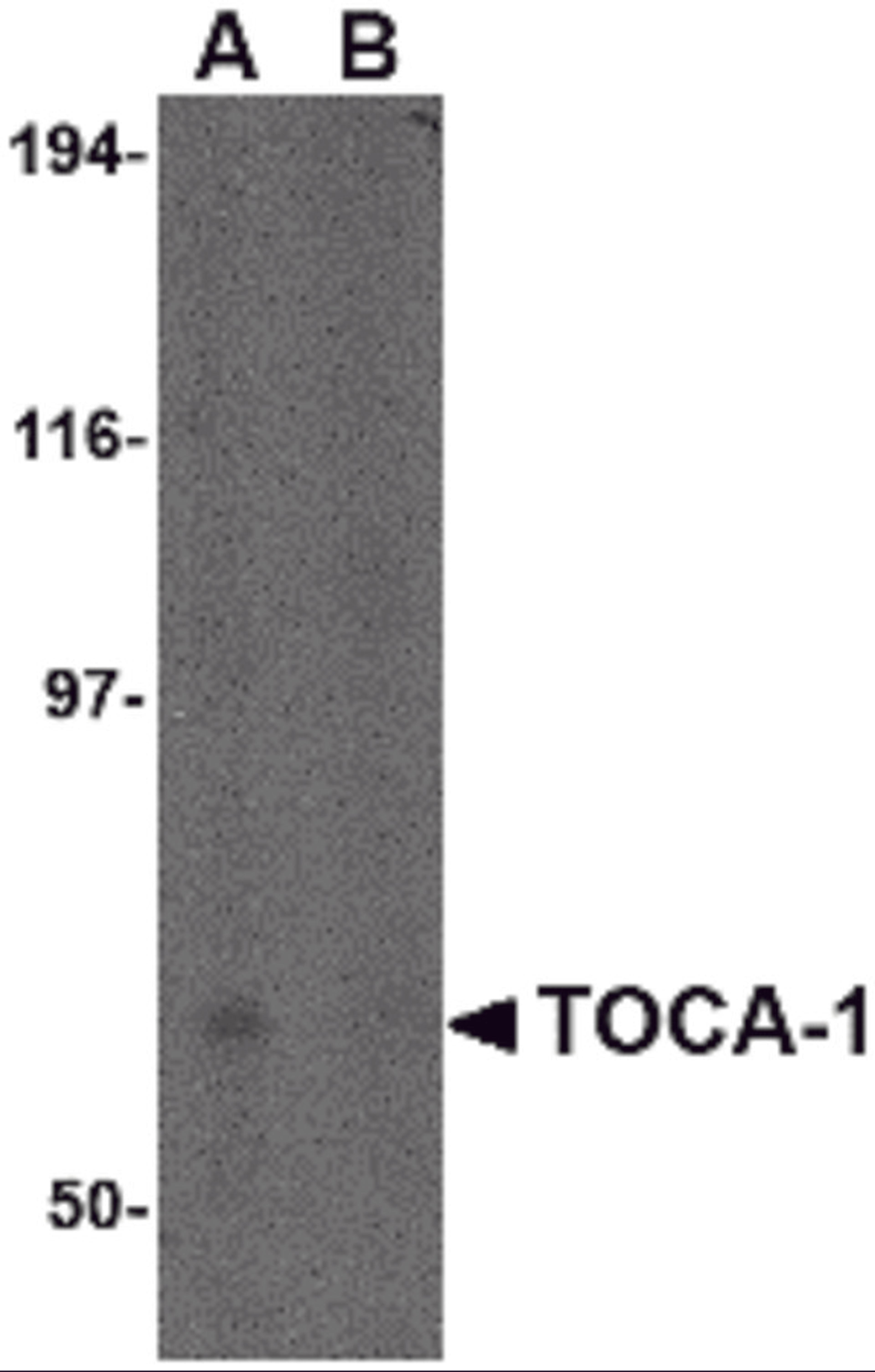 Western blot analysis of TOCA-1 in human brain tissue lysate in (A) the absence and (B) the presence of blocking peptide with TOCA-1 antibody at 0.5 &#956;g/mL.