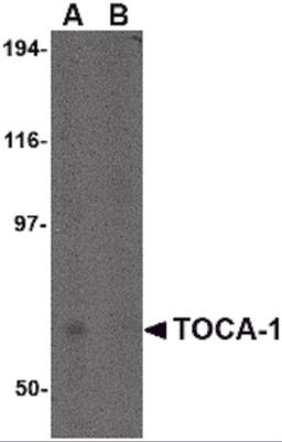 Western blot analysis of TOCA-1 in human brain tissue lysate in (A) the absence and (B) the presence of blocking peptide with TOCA-1 antibody at 0.5 μg/mL.