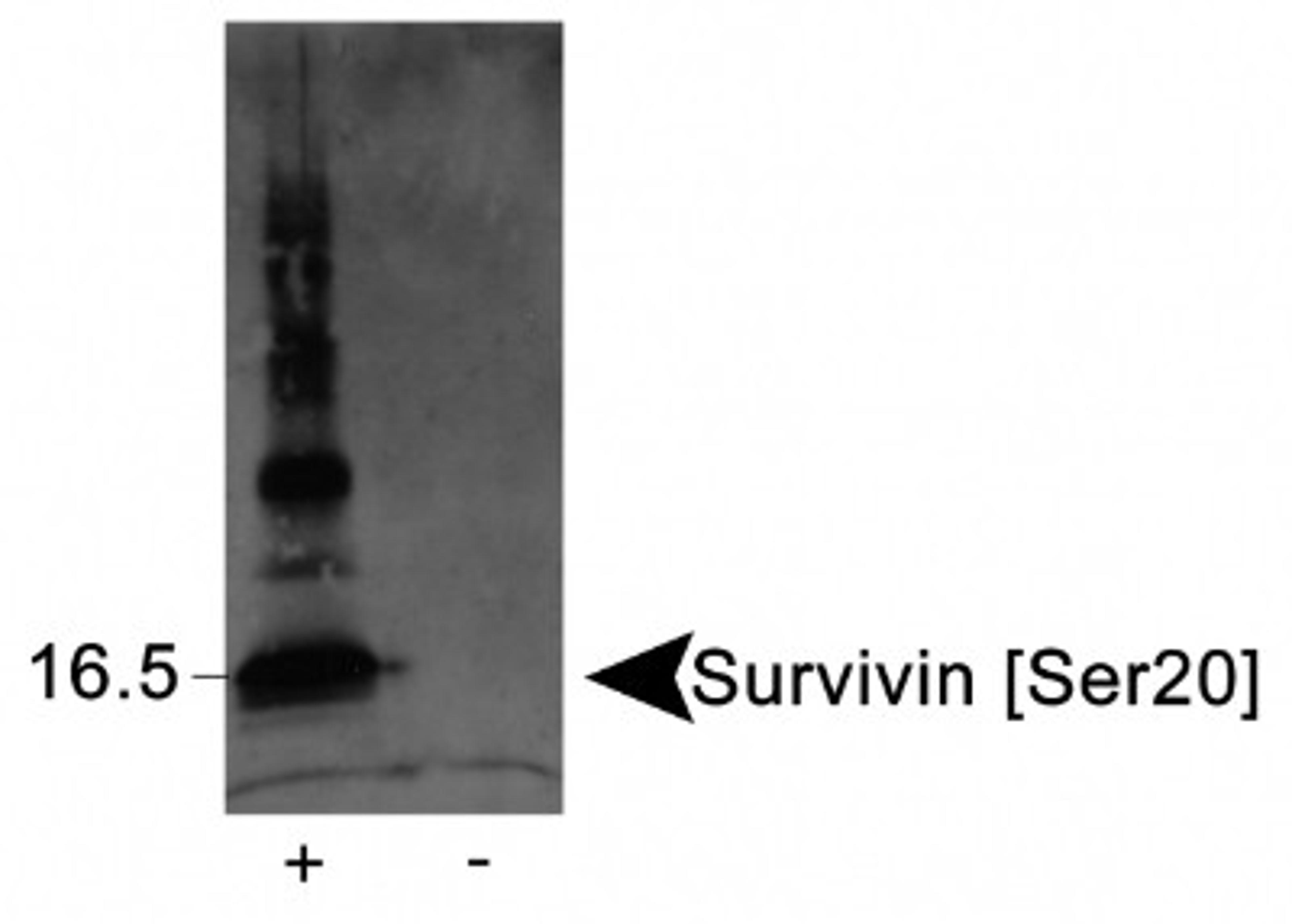 Western Blot: Survivin [p Ser20] Antibody [NB110-92717] - Detection of Survivin [Ser20] in phosphorylated recombinant protein (+), but not in unphosphorylated protein (-) using NB110-92717.