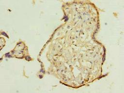 Immunohistochemistry of paraffin-embedded human placenta tissue using CSB-PA023683LA01HU at dilution of 1:100