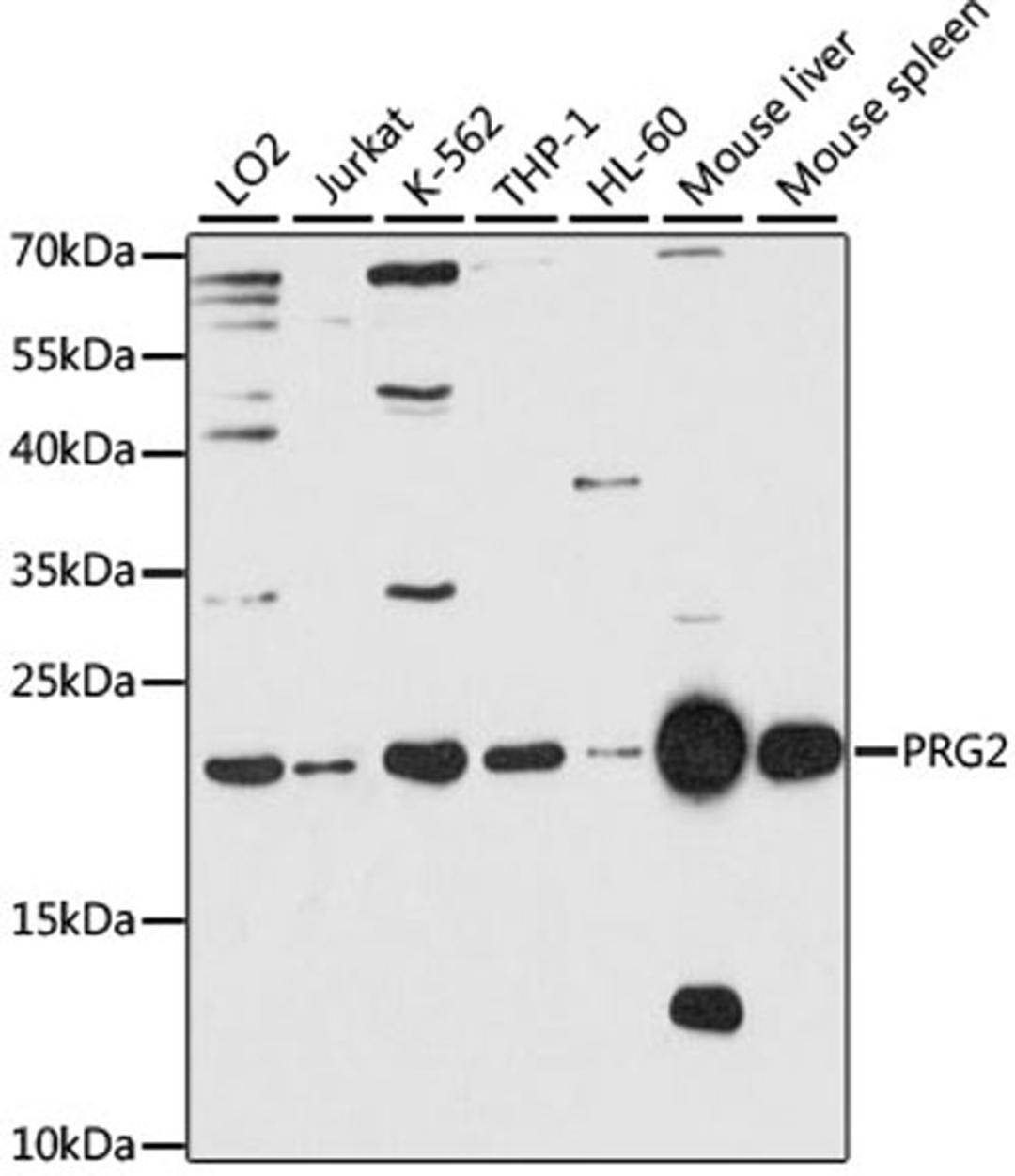 Western blot - PRG2 antibody (A2532)