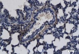 Immunohistochemical analysis of paraffin-embedded rat lung tissue using FGF21 antibody.