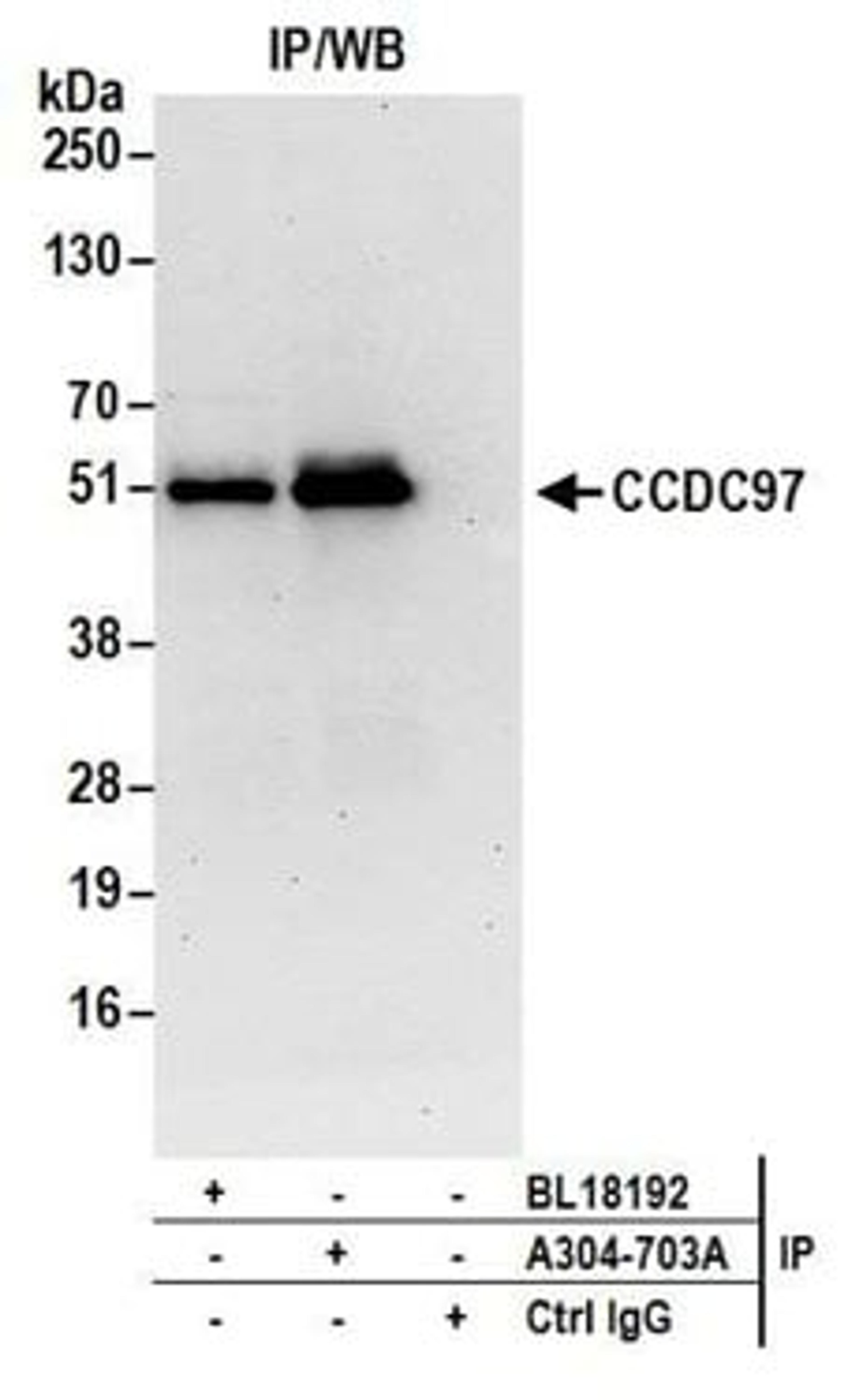 Detection of human CCDC97 by western blot of immunoprecipitates.