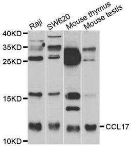 Western blot analysis of extracts of NCL-H460 using CCL17 antibody