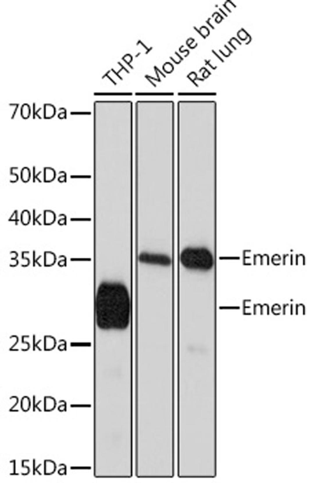 Western blot - Emerin Rabbit mAb (A4187)