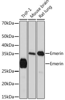 Western blot - Emerin Rabbit mAb (A4187)