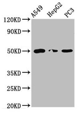 Western Blot. Positive WB detected in: A549 whole cell lysate, HepG2 whole cell lysate, PC-3 whole cell lysate. All lanes: IFT52 antibody at 5.1µg/ml. Secondary. Goat polyclonal to rabbit IgG at 1/50000 dilution. Predicted band size: 50 kDa. Observed band size: 50 kDa