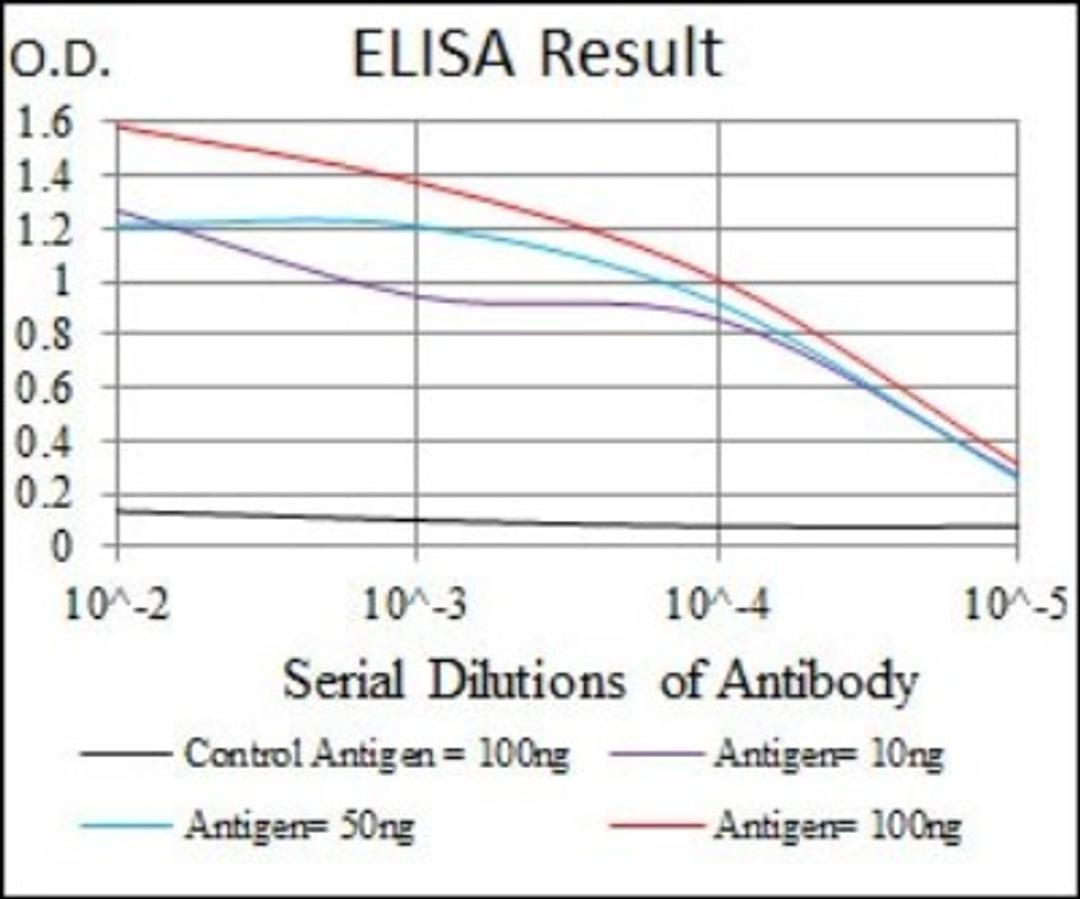 ELISA: C-Reactive Protein/CRP Antibody (1G1) [NBP2-22192] - Red: Control Antigen (100ng); Purple: Antigen (10ng); Green: Antigen (50ng); Blue: Antigen (100ng)