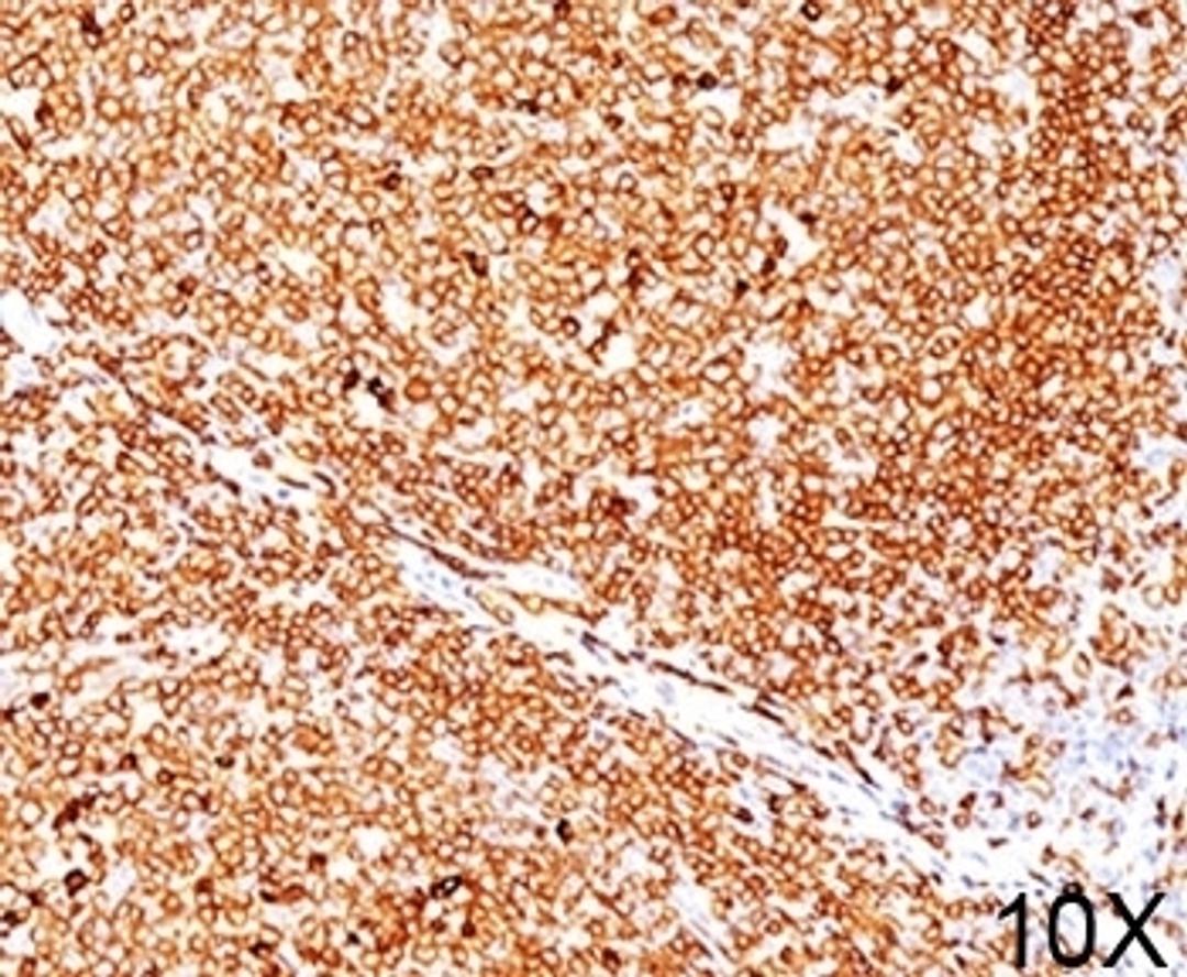 IHC testing of human tonsil (10X) stained with CD79a antibody (JCB117).