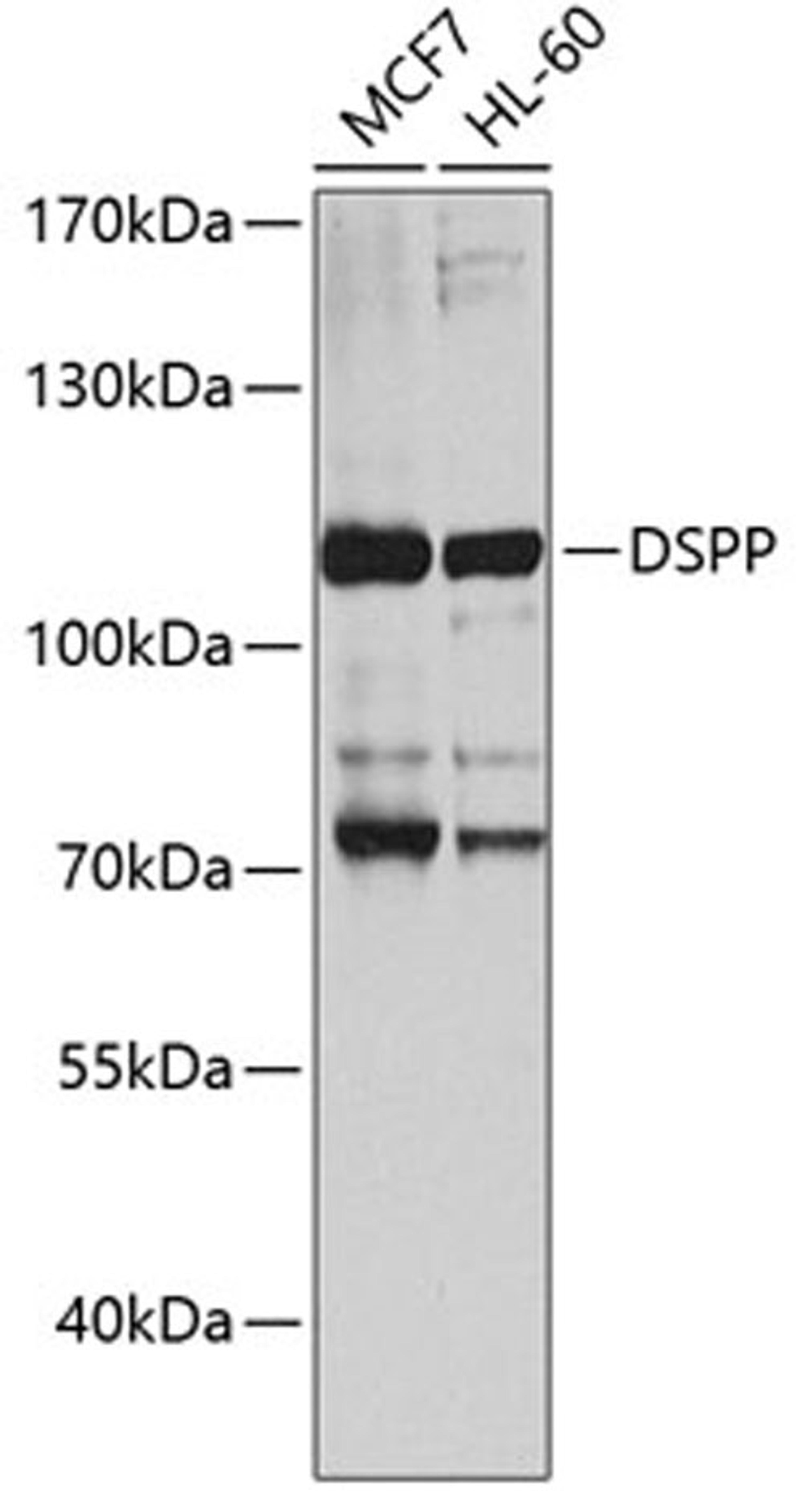 Western blot - DSPP antibody (A8413)