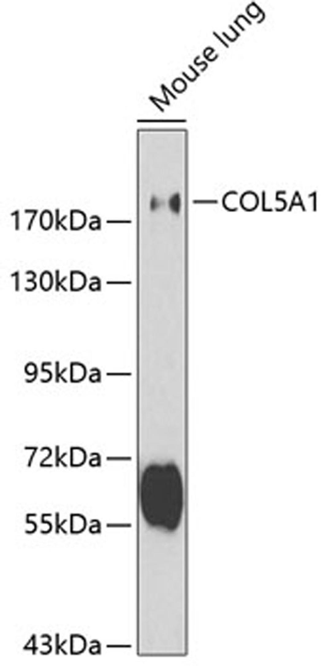 Western blot - COL5A1 antibody (A1515)