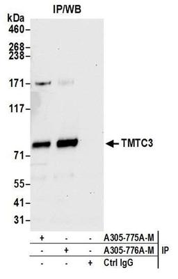 Detection of human TMTC3 by WB of IP.