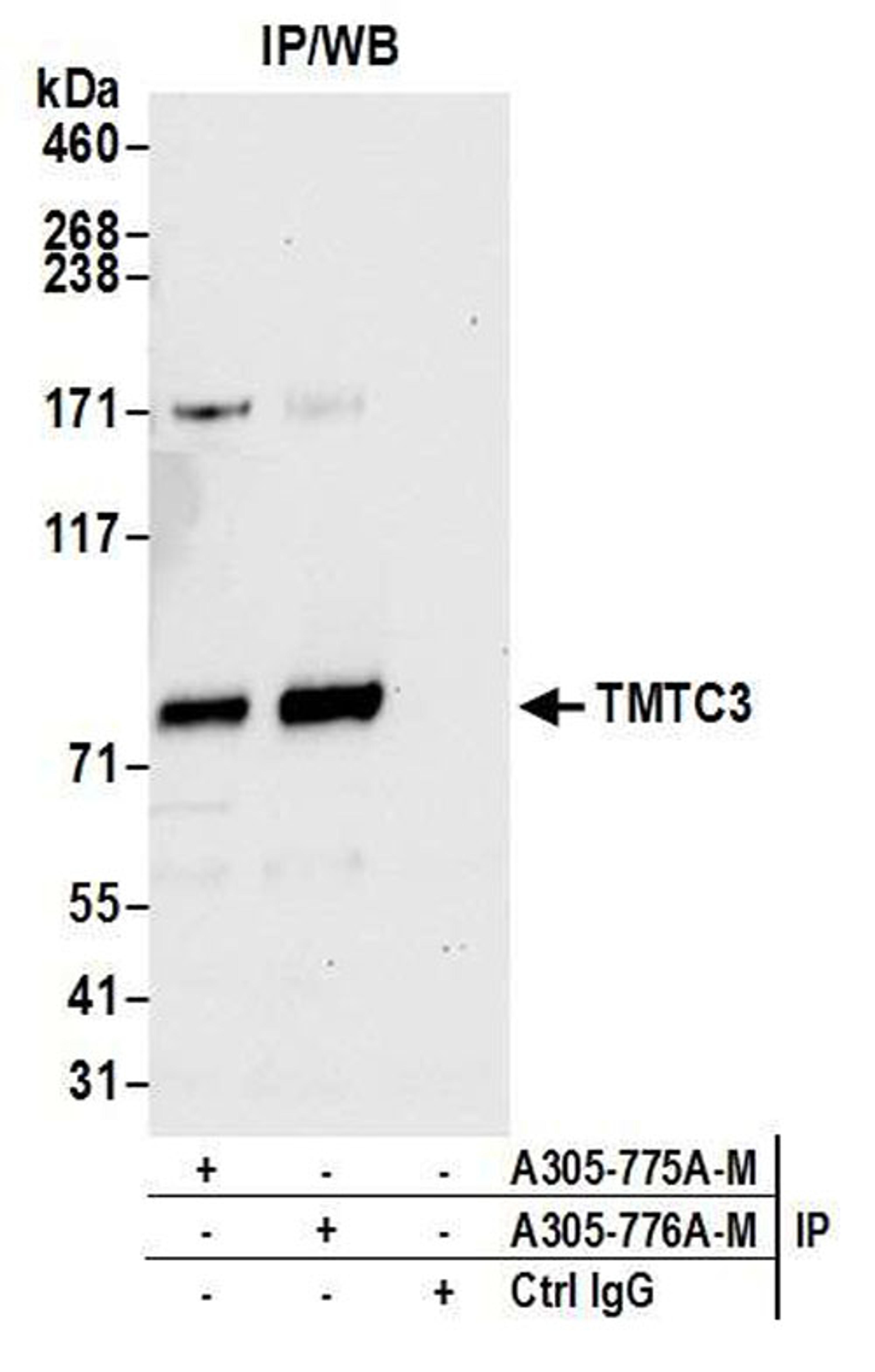 Detection of human TMTC3 by WB of IP.