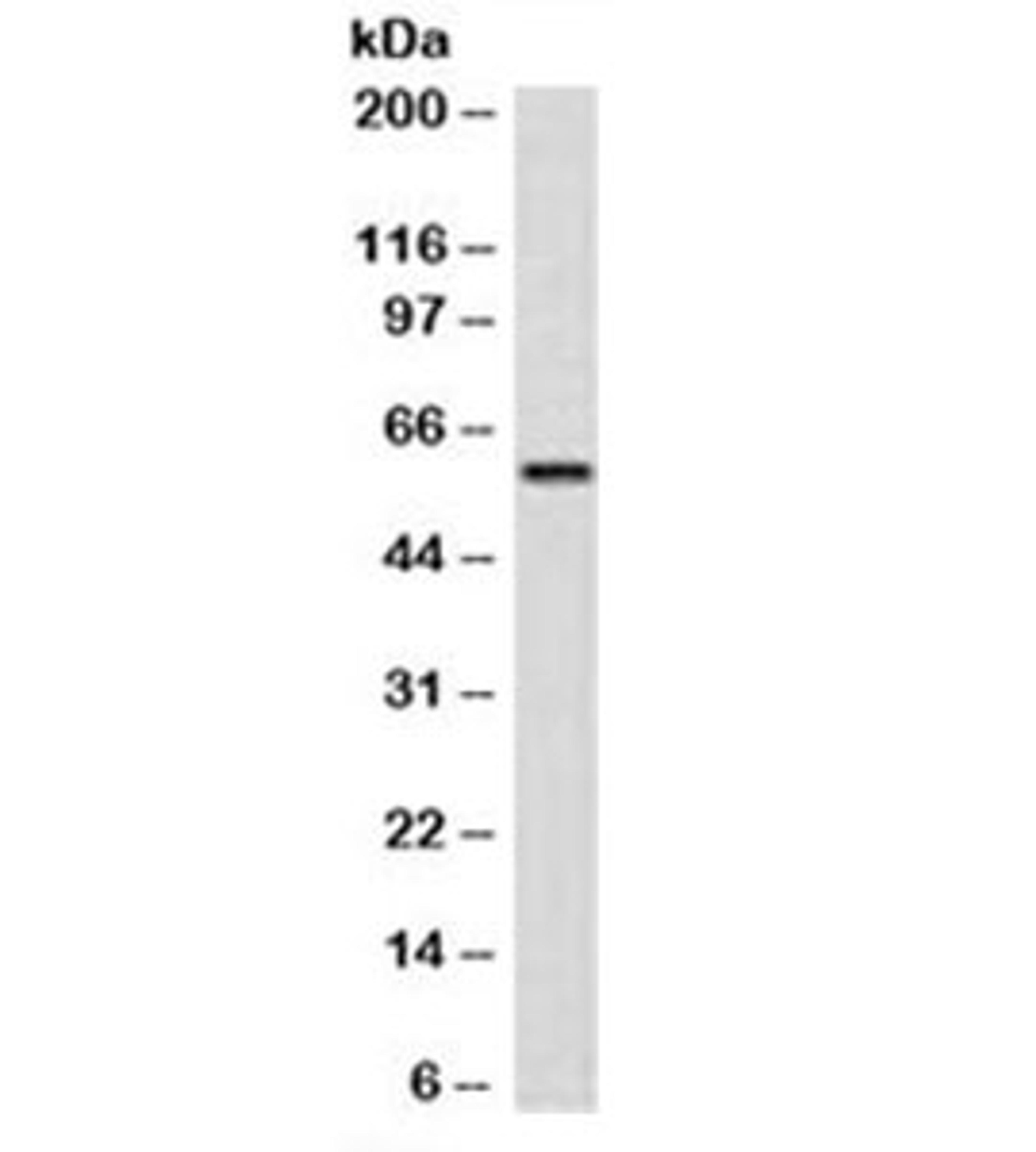 Western blot testing of human PBM lysate with GnRH Receptor antibody (clone A9E4). Predicted molecular weight ~38/60kDa (unmodified/glycosylated).