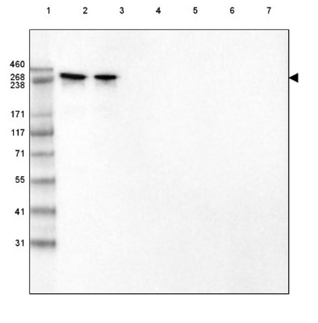 Immunohistochemistry: Laminin alpha 2 Antibody (3450) [NBP2-46624] - Lane 1: Marker [kDa] 460, 268, 238, 171, 117, 71, 55, 41, 31.  Lane 2: Purified human recombinant protein Laminin-211.  Lane 3: Purified human recombinant protein Laminin-221.  Lane 4: Purified human recombinant protein Laminin-332.  Lane 5: Purified huma