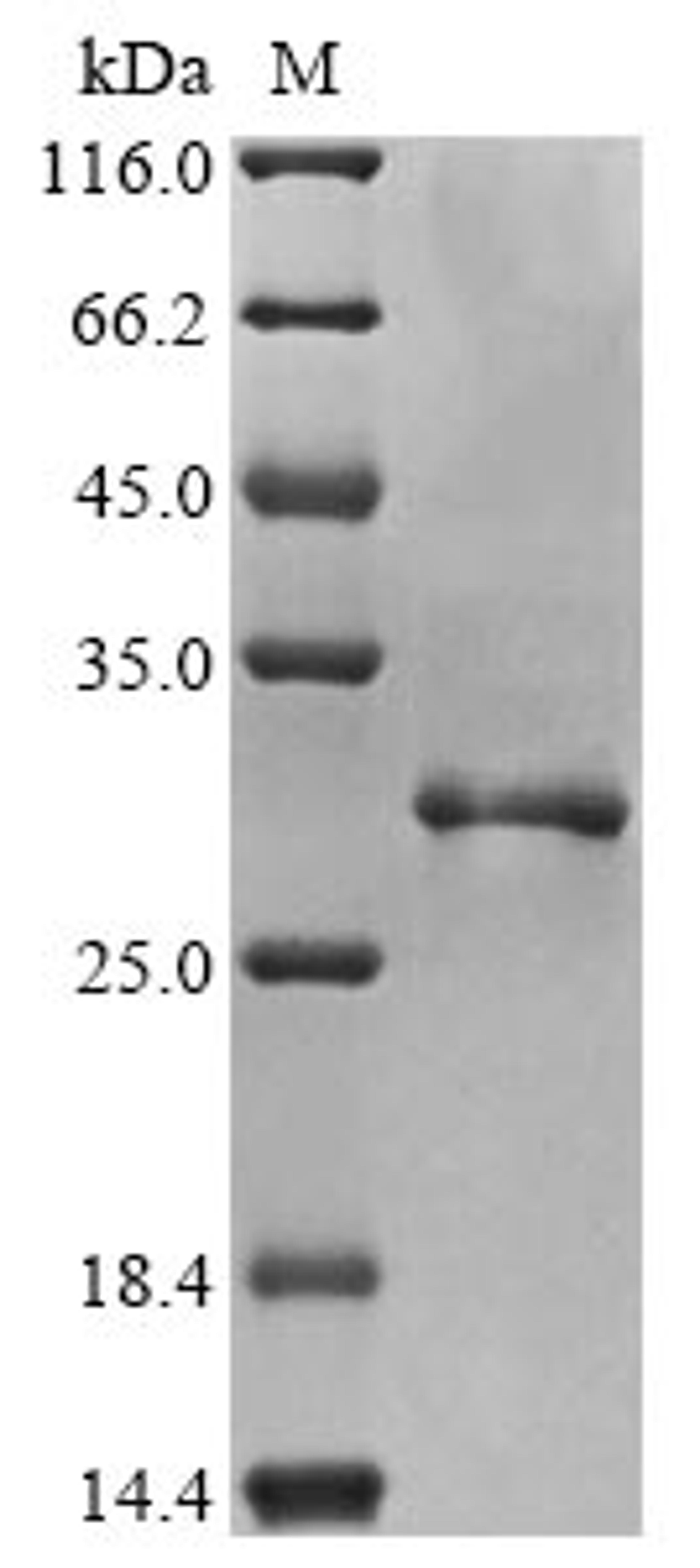 (Tris-Glycine gel) Discontinuous SDS-PAGE (reduced) with 5% enrichment gel and 15% separation gel.