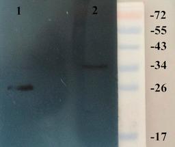 Western blot analysis of rat kidney (Lane 1), rat brain (Lane 2) using HMGB1 antibody (dilution at 1:200)