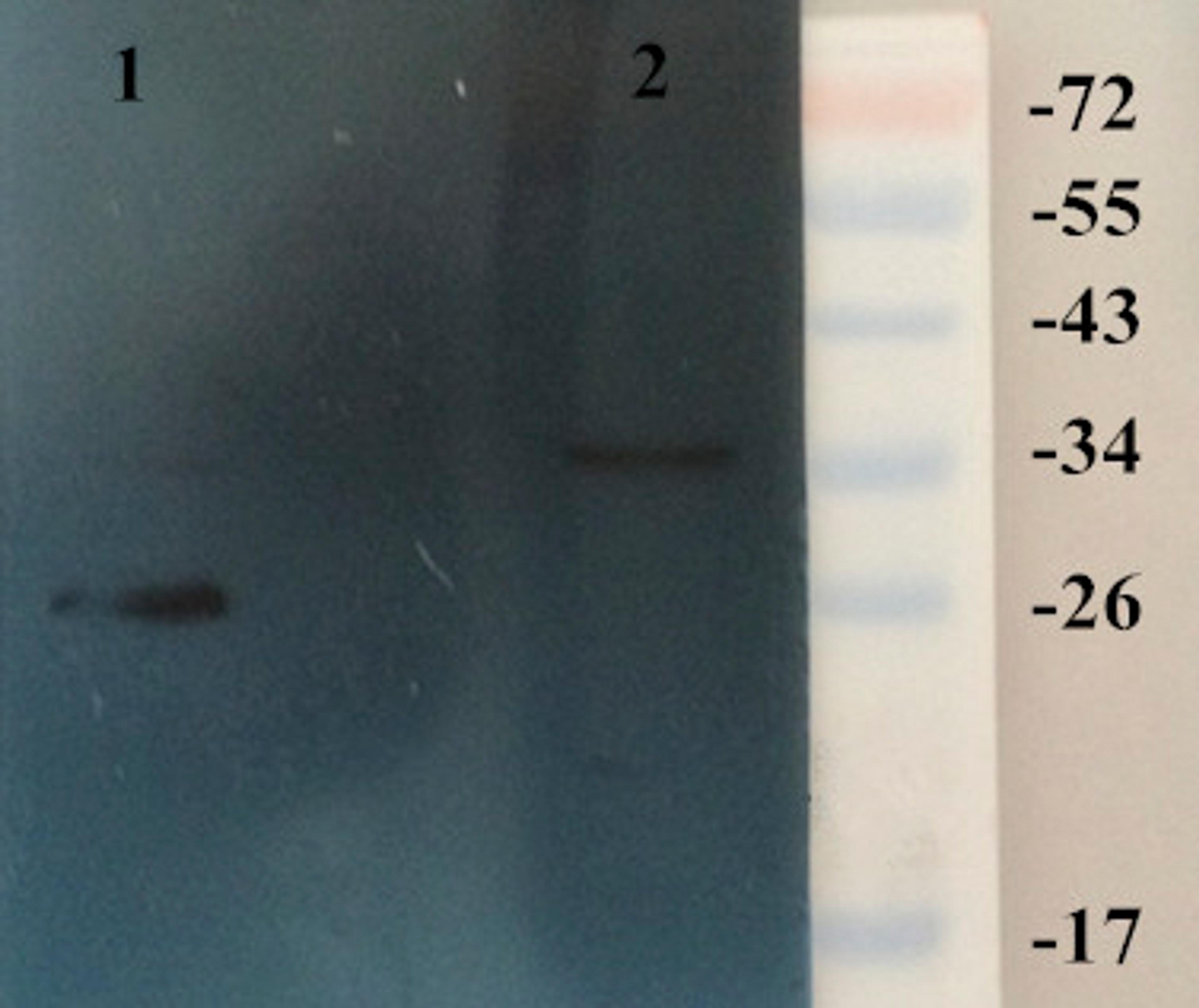 Western blot analysis of rat kidney (Lane 1), rat brain (Lane 2) using HMGB1 antibody (dilution at 1:200)