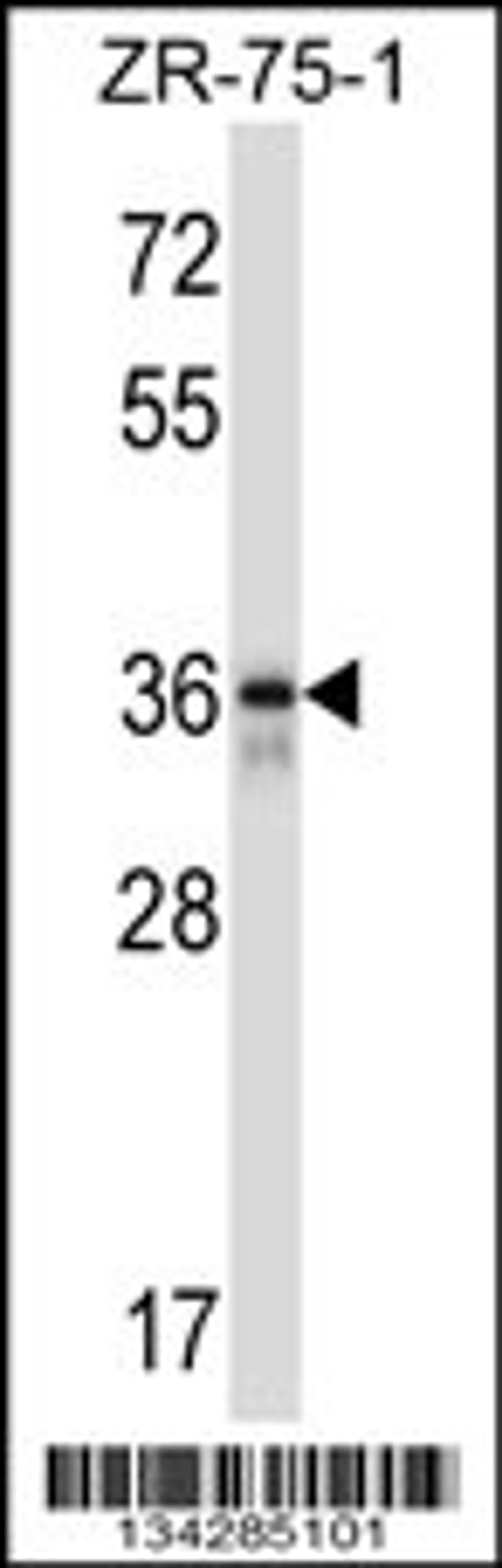 Western blot analysis in ZR-75-1 cell line lysates (35ug/lane).