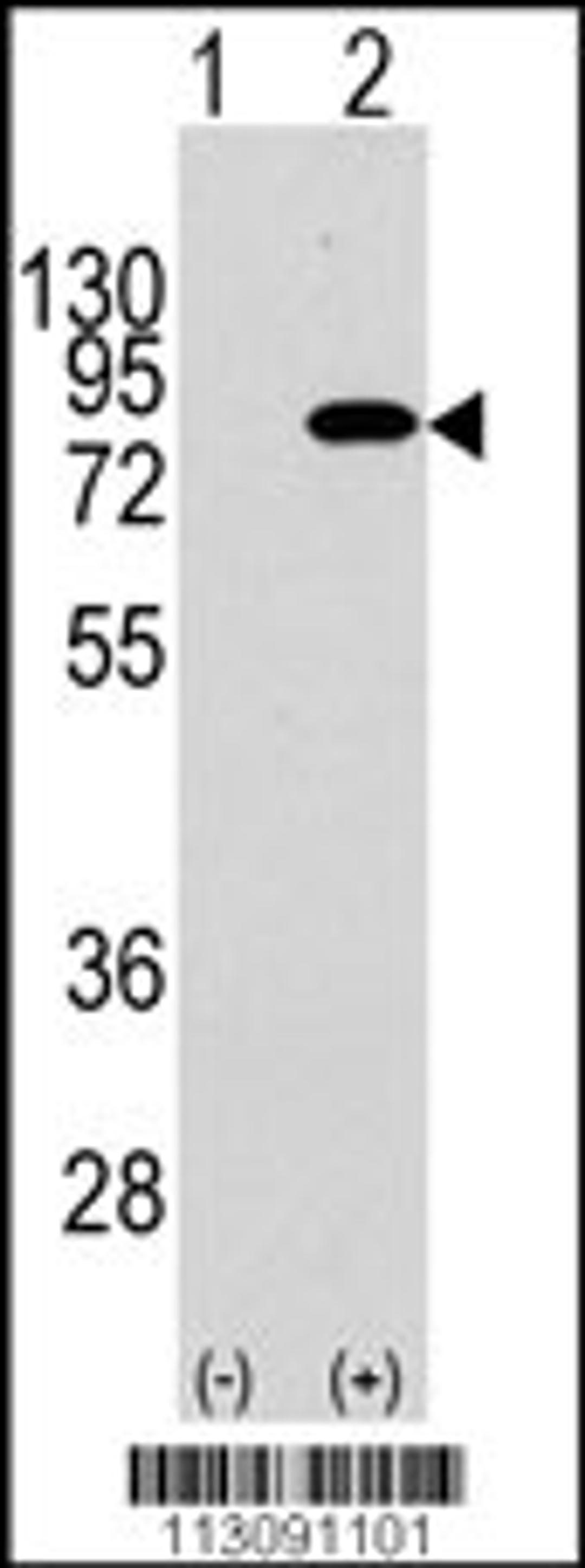 Western blot analysis of PIK3R2 using rabbit polyclonal PIK3R2 Antibody (Y467) using 293 cell lysates (2 ug/lane) either nontransfected (Lane 1) or transiently transfected with the PIK3R2 gene (Lane 2).