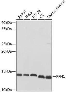 Western blot - PFN1 Polyclonal Antibody (A1164)