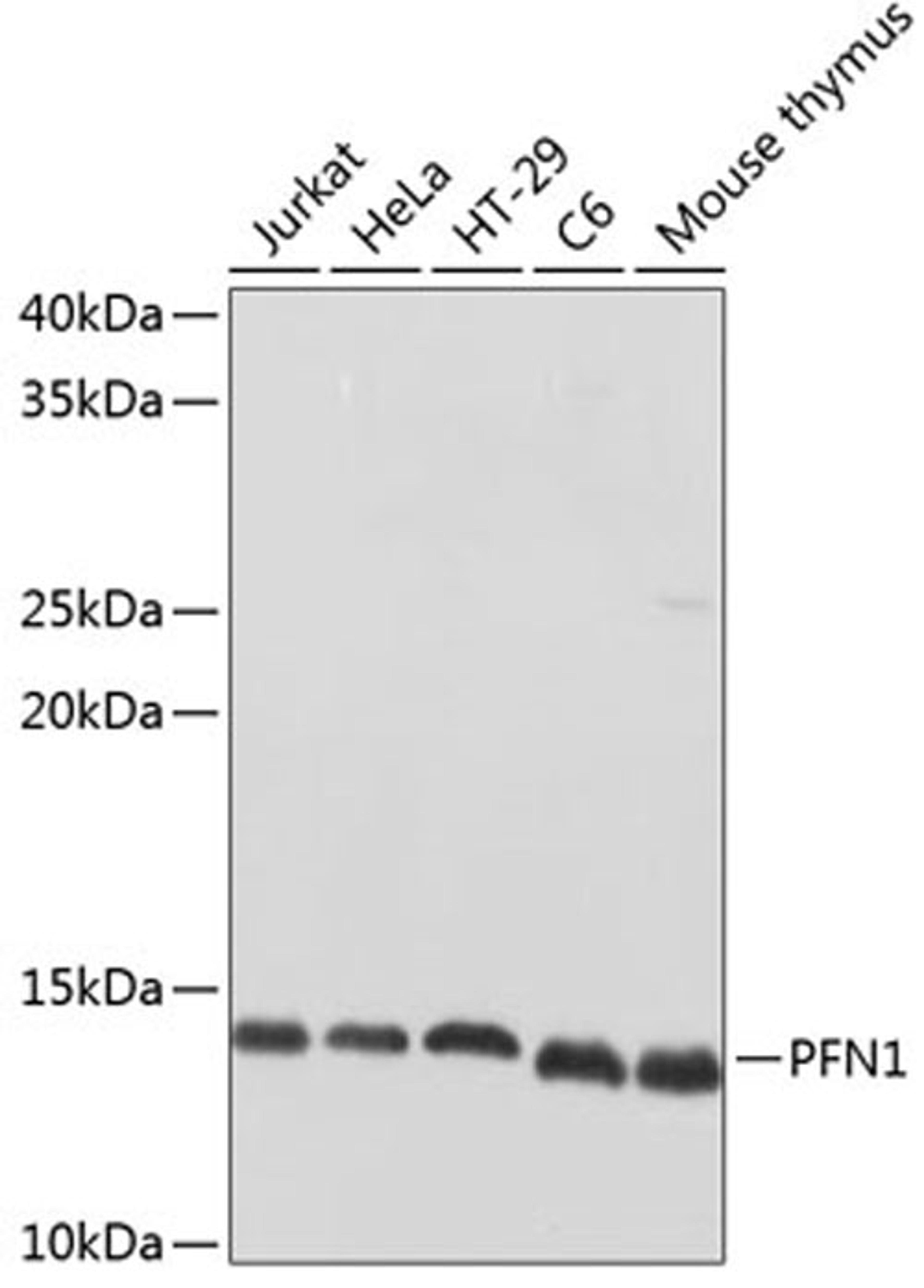 Western blot - PFN1 Polyclonal Antibody (A1164)