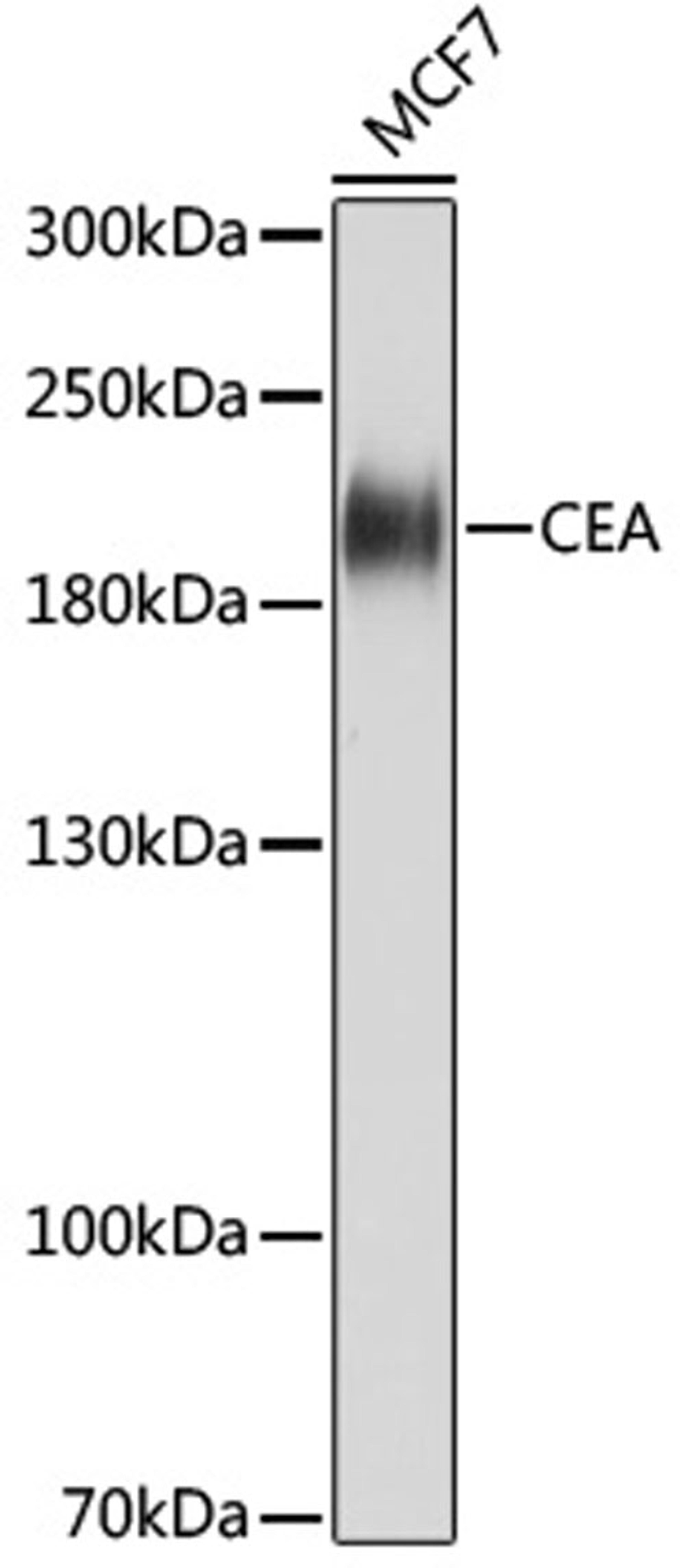 Western blot - CEA antibody (A18131)