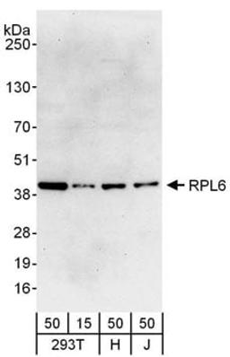 Detection of human RPL6 by western blot.