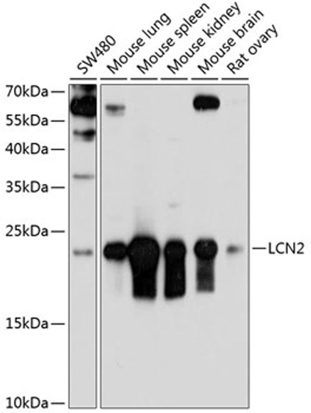Western blot - LCN2 antibody (A3176)