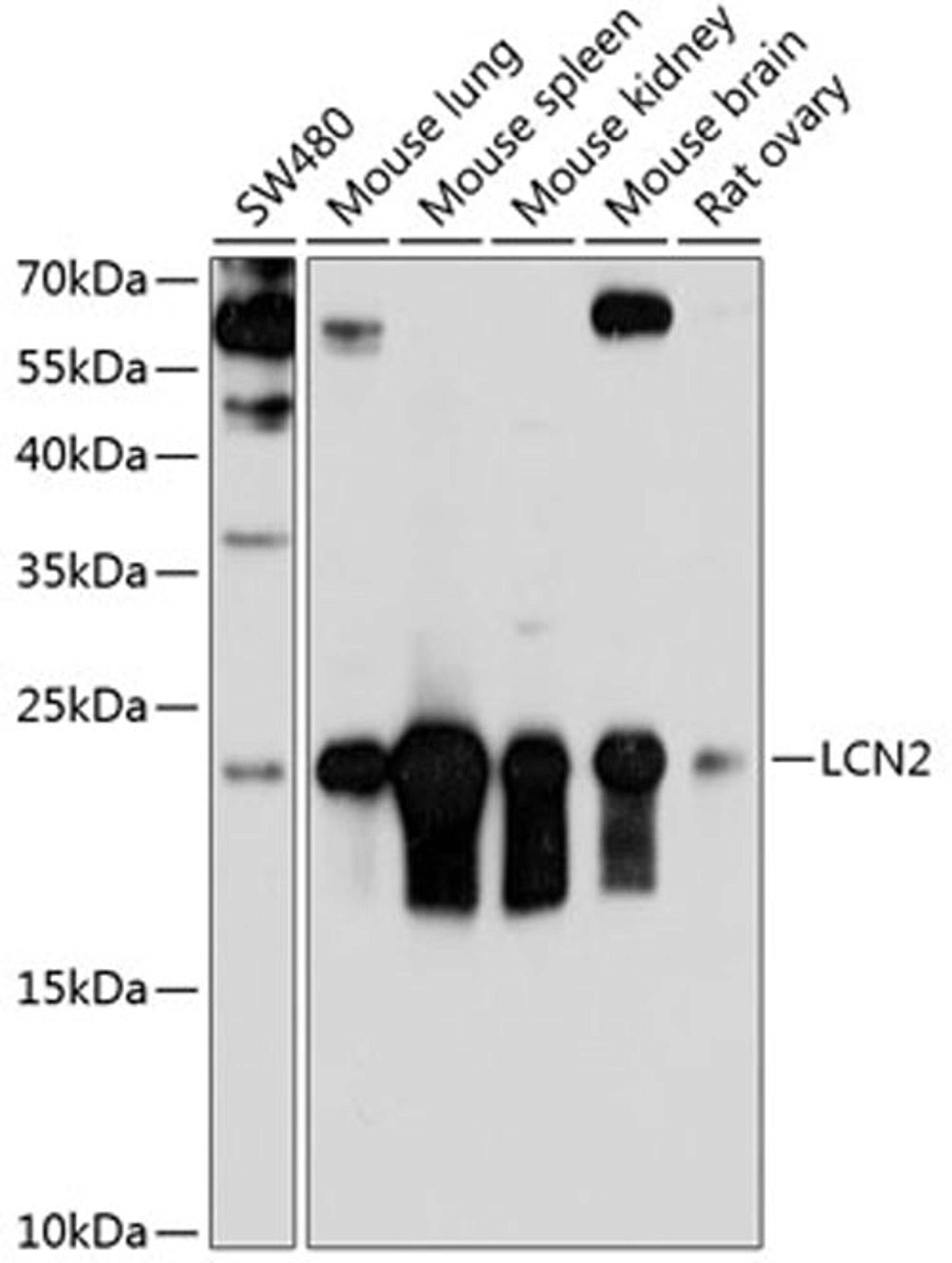 Western blot - LCN2 antibody (A3176)