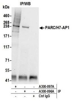 Detection of human PARC/H7-AP1 by western blot of immunoprecipitates.