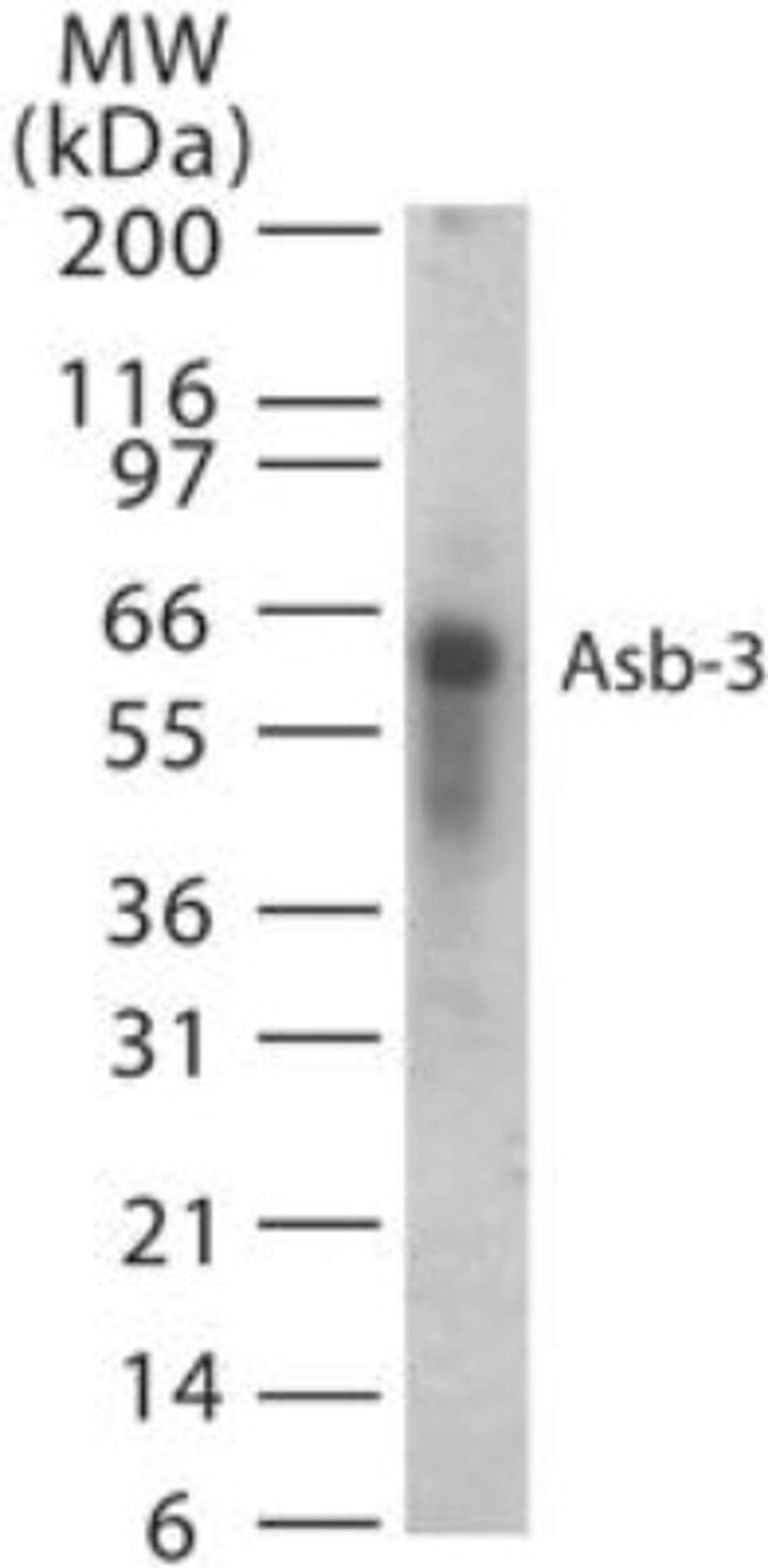 Western Blot: ASB3 Antibody [NB100-56645] - Western blot analysis of ASB3 in 15 ugs of human spleen cell lysate using NB100-56645 at 1:1000 dilution.