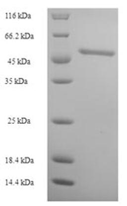 (Tris-Glycine gel) Discontinuous SDS-PAGE (reduced) with 5% enrichment gel and 15% separation gel.