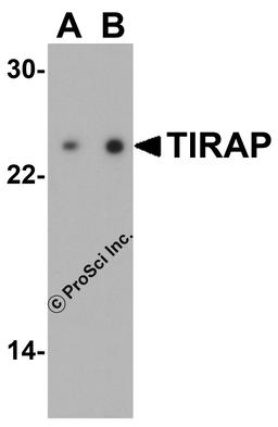 Western blot analysis of TIRAP in human heart tissue lysate with TIRAP antibody at (A) 1 and (B) 2 μg/mL.